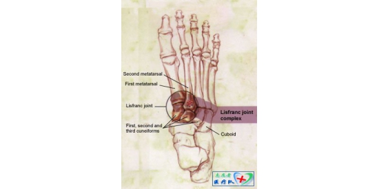 Lisfranc˸