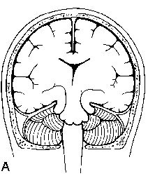 hern_central.jpg (26902 bytes)