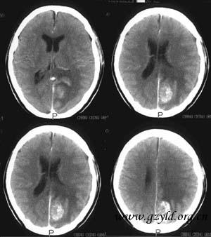 ex1 cte.jpg (18911 bytes)