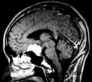 sell m1 mri.jpg (20843 bytes)